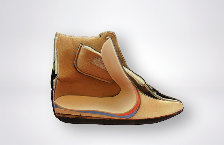 Schuhzurichtung mit Vorfußersatz